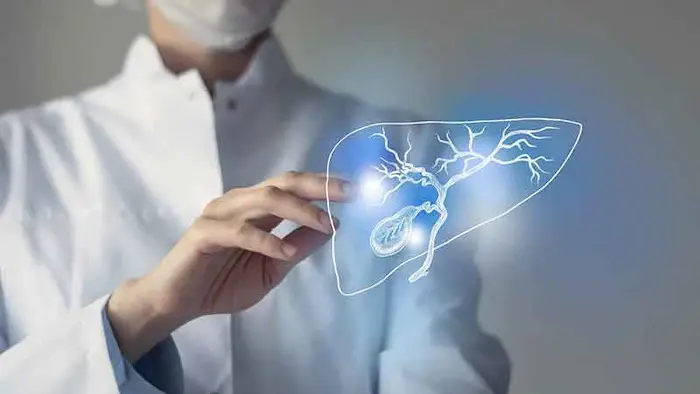 المرحلة الرابعة من سرطان الكبد الأعراض طرق العلاج والتوقعات المرحلة الرابعة من سرطان الكبد الأعراض طرق العلاج والتوقعات