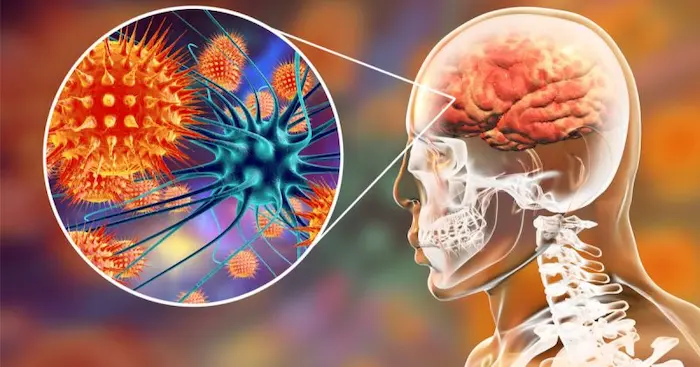 مضاعفات الحمى الشوكية وكيفية الوقاية منها مضاعفات الحمى الشوكية وكيفية الوقاية منها
