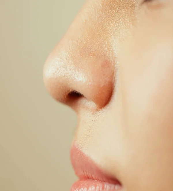 تجميل الأنف