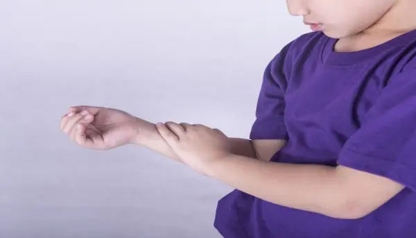 أعراض الروماتيزم عند الأطفال