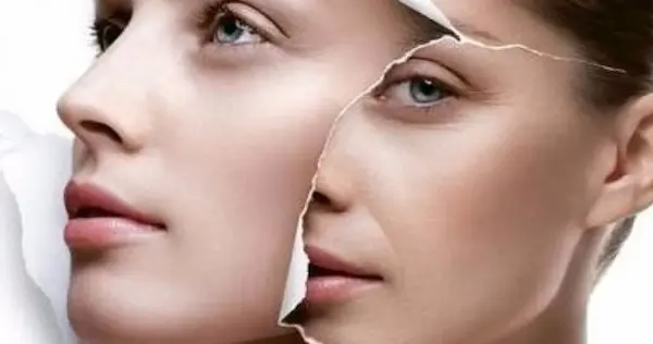 إعادة بناء الوجه