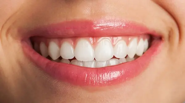 ابتسامة هوليوود