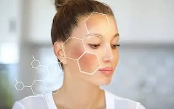 التصبغات الجلديه التصبغات الجلديه