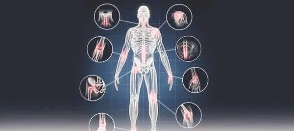 أعراض هجمات الفيبروميالجيا أعراض هجمات الفيبروميالجيا