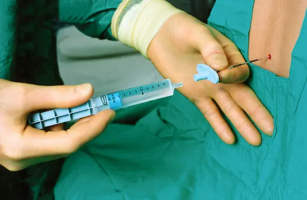 ابرة الظهر ابرة الظهر