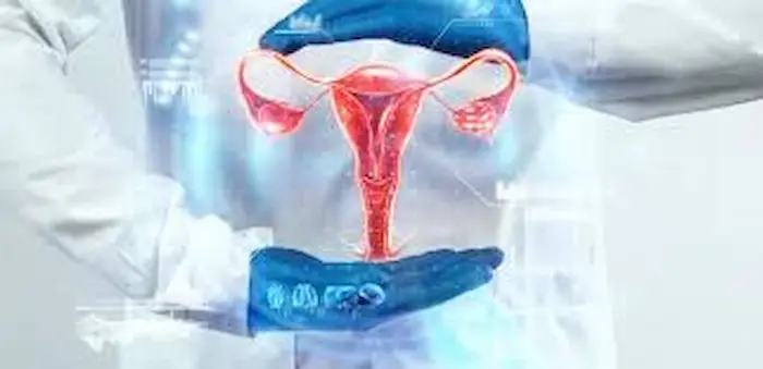 ربط عنق الرحم ربط عنق الرحم