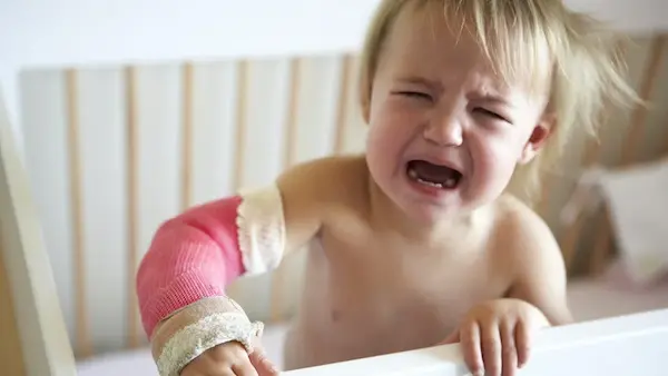 كسور الاطفال كسور الاطفال