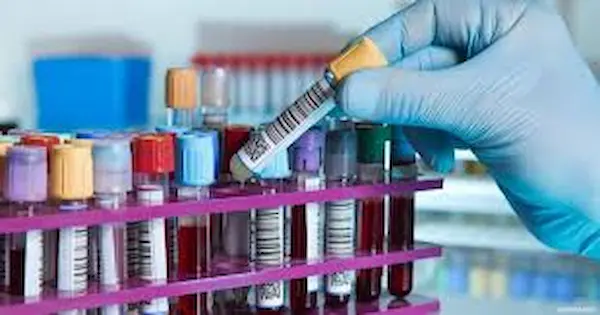 معامل تحاليل الاورام معامل تحاليل الاورام