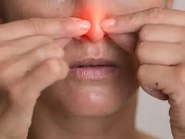 إصلاح ثقب الحاجز الأنفي إصلاح ثقب الحاجز الأنفي