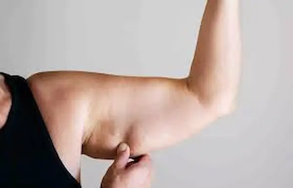 انواع ترهلات الزنود انواع ترهلات الزنود