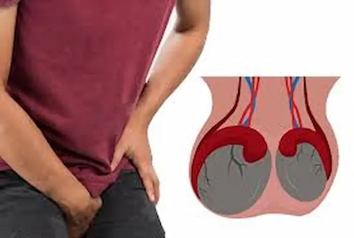 أسباب وأعراض صغر حجم الخصيتين مع 5 طرق فعالة لعلاجها