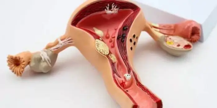 دليل شامل حول عملية رفع الرحم
